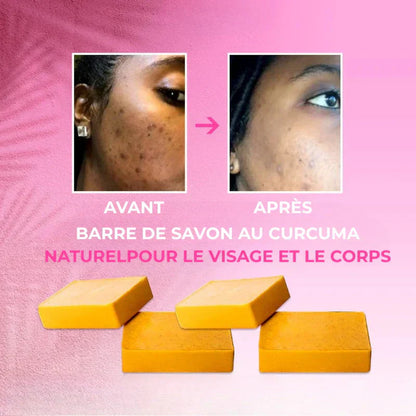 Savon au Curcuma Bio – Nettoyage Doux et Peau Éclatante